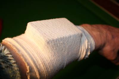 Support Bandage holding zapper on arm