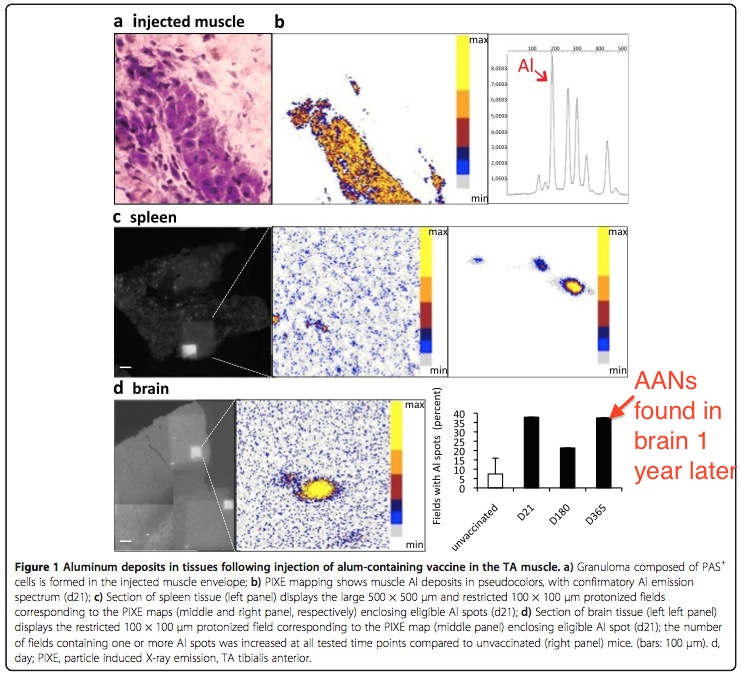 Al adjuvant detected in brain