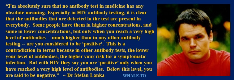 http://www.whale.to/vaccines/lankaantibodytest.jpg