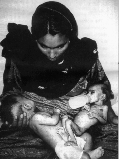 "Use my picture 
if it will help" said this mother.  The children are twins, the 
bottle-fed child is a girl who died the day after this photograph was 
taken by UNICEF in Islamabad, Pakistan.  Her brother was breastfed and 
thrived.   The mother was incorrectly told she could not breastfeed both
 children. This horrific picture demonstrates the risk of artificial 
infant feeding, particularly where water supplies are unsafe.  The 
expense of formula can lead to parents over-diluting it to make it last 
longer or using unsuitable milk powders or animal milks.  In all 
countries breastfeeding provides immunity against infections.  Despite 
these risks the baby food industry aggressively markets breastmilk 
substitutes encouraging mothers and health workers to favour artifical 
infant feeding over breastfeeding.  Such tactics break marketing 
standards adopted by the World Health Assembly. Nestlé, the world's 
largest food company, is found to be responsible for more violations 
than any other company and is the target of an international boycott.